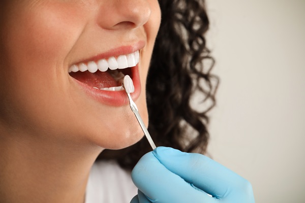 The Process Of Getting Dental Veneers: What To Expect